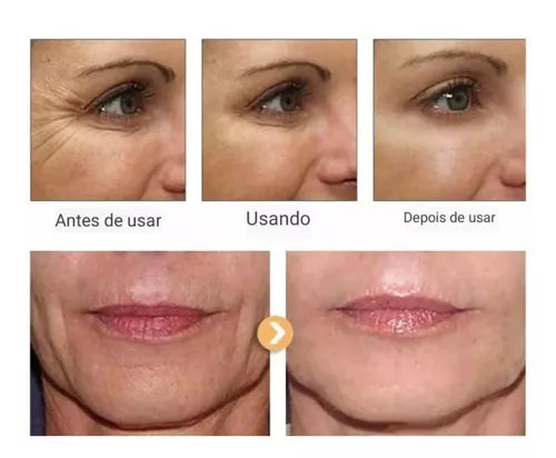 Creme Antirrugas Anti-idade Instantâneo 5 Segundos Unissex